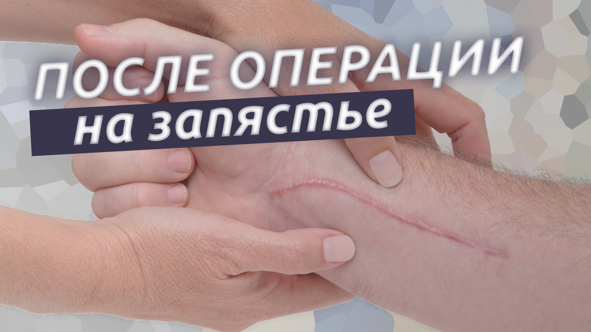 Реабилитация запястья. Что делать после операции на запястье? смотреть онлайн