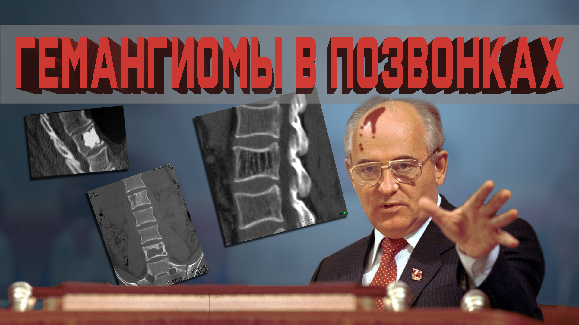 Что такое гемангиомы? Красные точки на теле? Или не только? смотреть онлайн