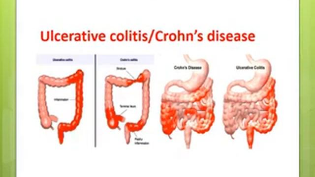DHB-2 Patho | GIT | Dr. Mahmud Tag смотреть онлайн