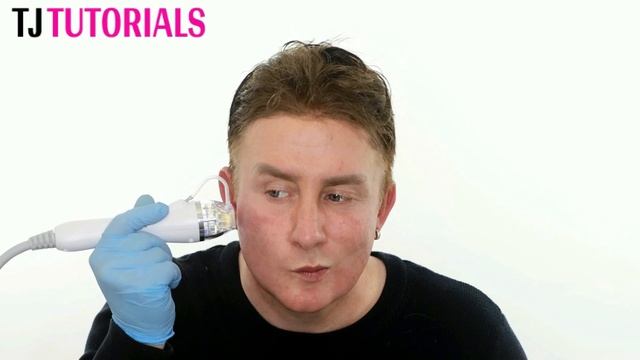 Fractional Radiofrequency Microneedling Skin Tightening | Before & After смотреть онлайн
