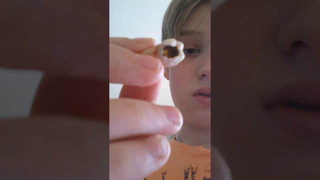 Последний зуб мудрости смотреть онлайн