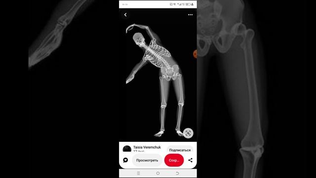 КАК СКАЧАТЬ ОБОИ ИЗ ПИНТЕРЕСТ И ПОСТАВИТЬ?ответ тут. смотреть онлайн