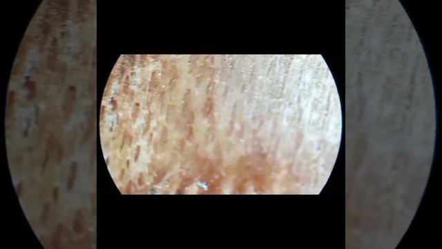 Кора Деревьев Под Микроскопом