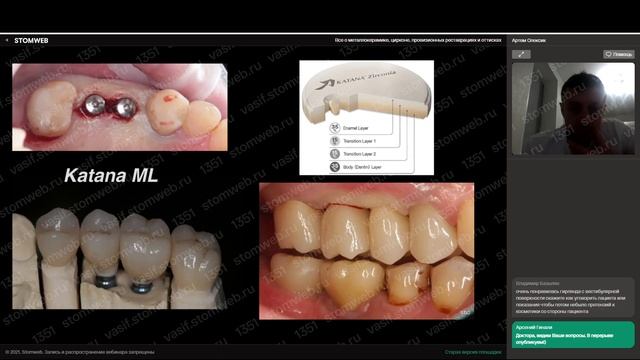 Артём Олексик - Все о металлокерамике, цирконе, провизионных реставрациях и оттисках смотреть онлайн