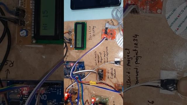 HEART RATE | ECG | HUMIDITY | Temperature Monitoring on ESP8266 IOT Using Arduino & ThingSpeak | SM смотреть онлайн