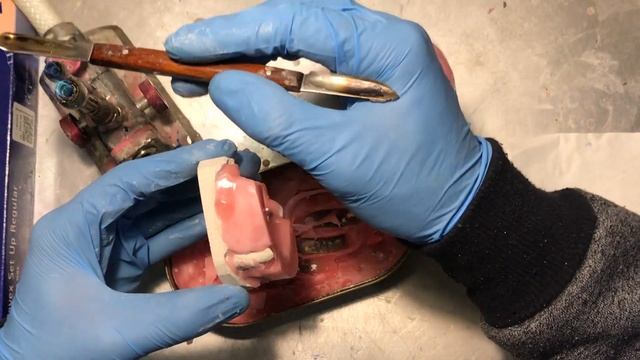 Зубной протез. Изготовление валика смотреть онлайн