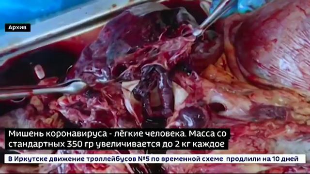 В Иркутском морге показали, что COVID делает с органами человека смотреть онлайн