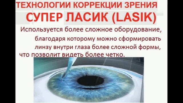 НЕпрофессор - Виды лазерной коррекции зрения. Обзор методов смотреть онлайн