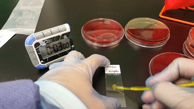 Microbiology: Fusarium Necrophorum Biochemical Testing & Colonial Growth