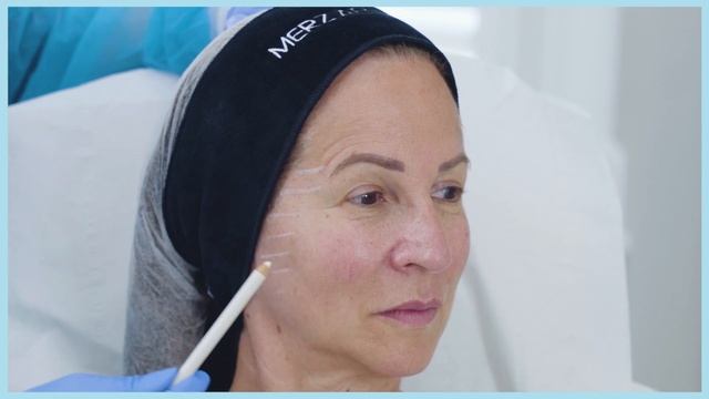 Tweak Of The Week: Mid-Face Volume Enhancement By Dr Kate Goldie With BELOTERO® Volume