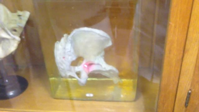 Соединения костей. Таз [2]. смотреть онлайн