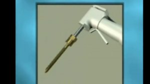 Имплантация зубов в Хэйхэ