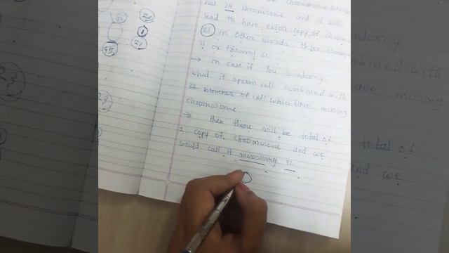 Down syndrome - trisomy 21 // congenital disease смотреть онлайн