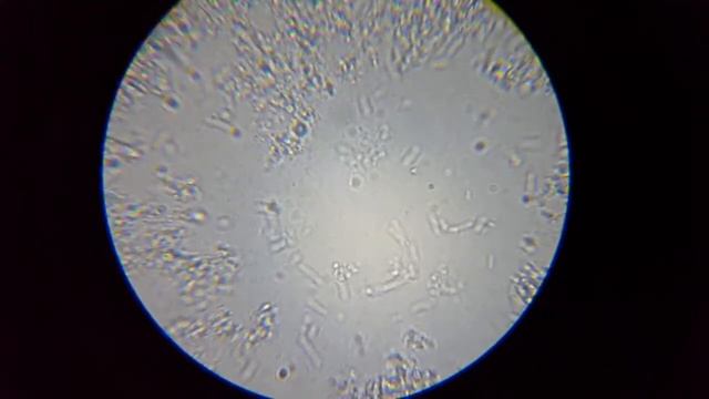 Lactobacillus acidophilus ( Лактобацилус ацидофилус )(Narine) смотреть онлайн