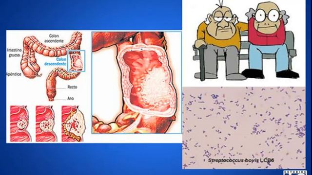 CyM infectologia - INFECTOLOGIA 2 7 смотреть онлайн