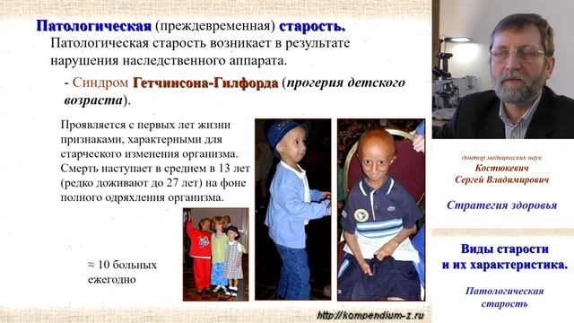 2.1 Виды старости. Патологическая старость смотреть онлайн