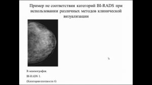 BIRADS: категоризация очаговых изменений молочных желез