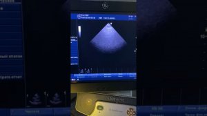 Практическое занятие 1. Определение давления в легочной артерии (Ерошенко О.Л.)