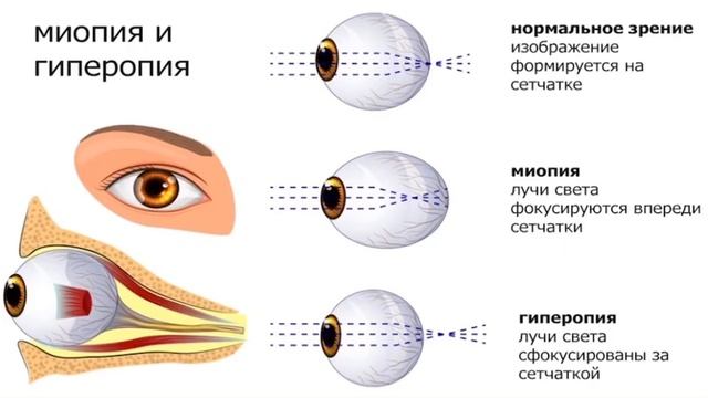 Глаз как оптическая система, дефекты зрения и способы их исправления 8 класс смотреть онлайн