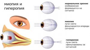 Глаз как оптическая система, дефекты зрения и способы их исправления 8 класс