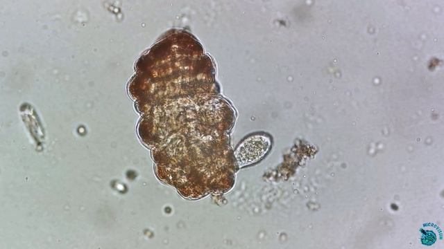 Tetrahymena напала на умирающую тихоходку! смотреть онлайн