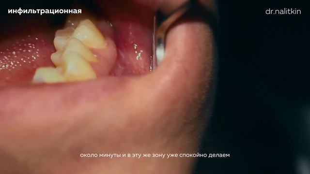 Как Правильно Делать Анестезию смотреть онлайн