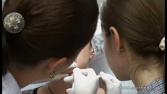 Веерная техника, канюли смотреть онлайн