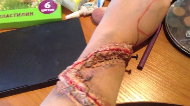 Рана на руке. Слабонервным просьба не смотреть!!! смотреть онлайн
