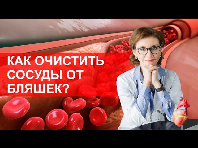 Как очистить сосуды от холестериновых бляшек? смотреть онлайн