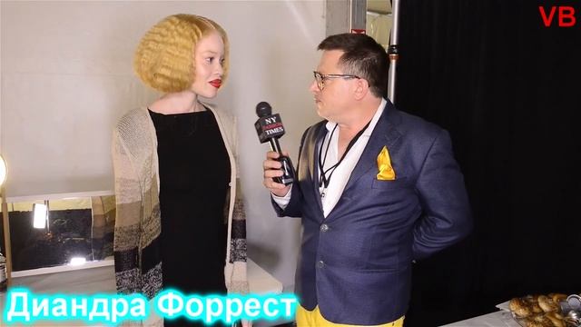 Кто такие Альбиносы? 10 людей с необычно белым оттенком кожи! смотреть онлайн