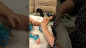 Накладываем тейпы при варусной деформации стопы