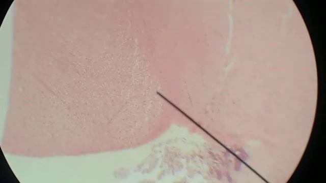 198 Гипофиз смотреть онлайн