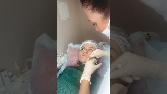 Лайфхак Как поставить филлер в носогубки??