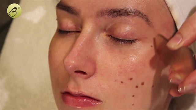 избавляемся от мешков, морщин и синяков вокруг глаз с Bl'ane Aromessence смотреть онлайн
