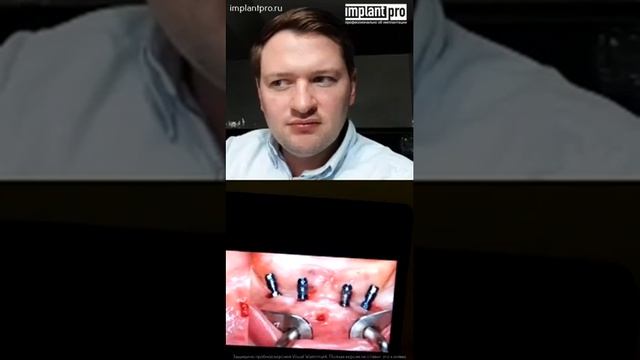 ПАВЕЛ ЯРОШЕВИЧ и AЛЬГИРДАС ПУЙШИС - биологические аспекты работы с мягкими тканями смотреть онлайн