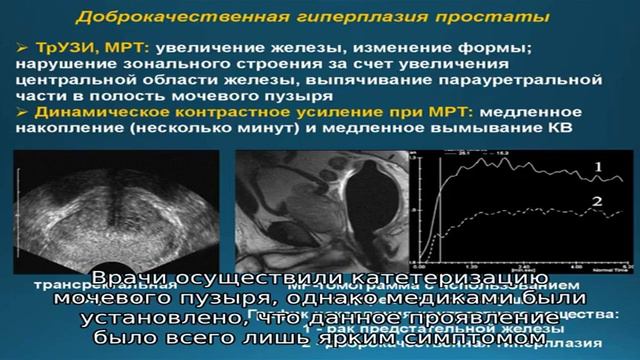 Составление истории болезни при аденоме предстательной железы смотреть онлайн