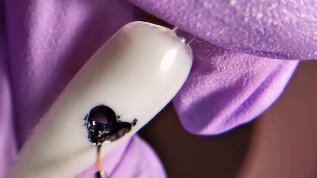 Как безопасно выпилить углубление в ногте. смотреть онлайн