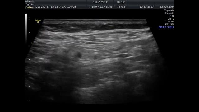 Тело в действии