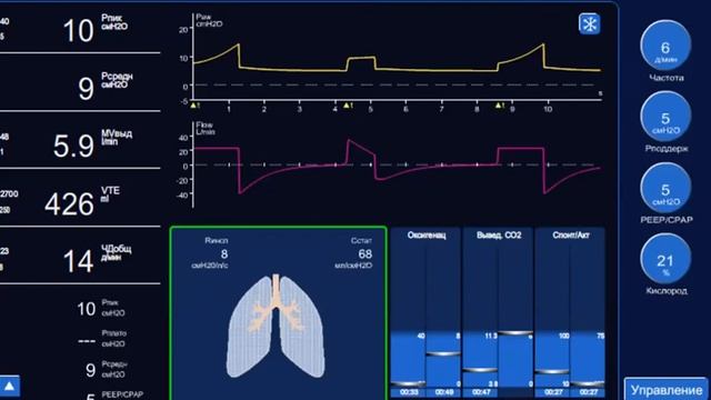 Симуляция ИВЛ на персональномкомпьютере Горячев А.С. смотреть онлайн