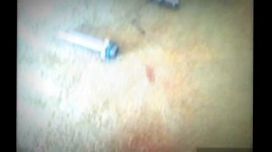 Чистка газовых форсунок