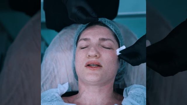 Zarina Bagirovadan Pilinq Proseduru