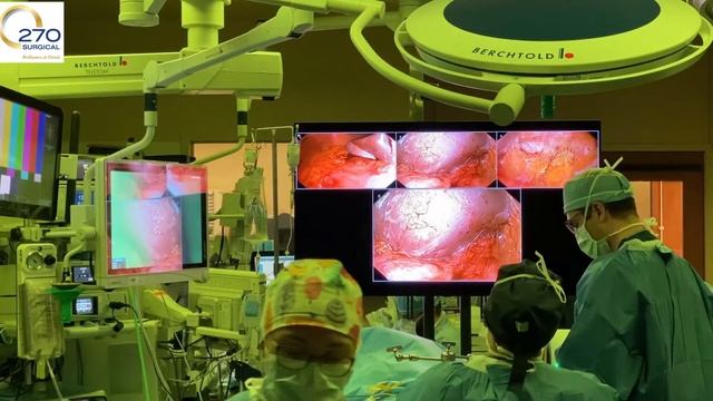 Surgeons react to the additional views in their second case using Surroundscope смотреть онлайн