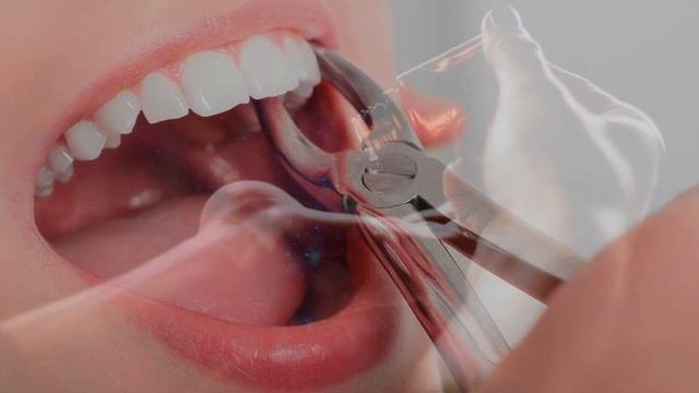 LA SANGRE DE DRAGO ¿Qué es? y para que sirve смотреть онлайн