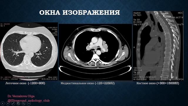 КТ Vs МРТ. Методы лучевой диагностики. Часть 3