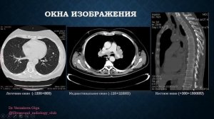 КТ vs МРТ. Методы лучевой диагностики. Часть 3