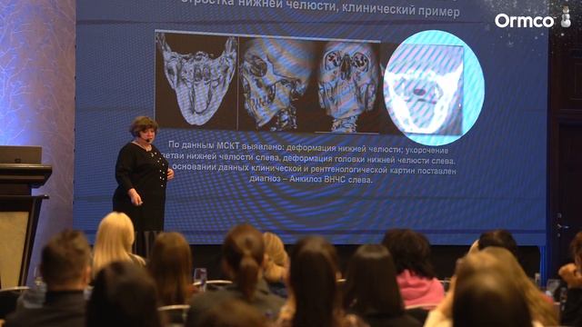 Рождественские встречи с Ormco 2022 смотреть онлайн