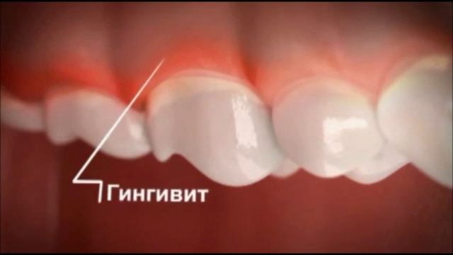 Стоматология №1 - профилактика смотреть онлайн
