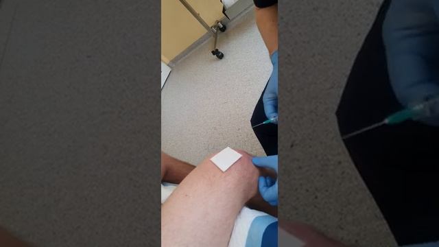 Укол в колено, Гиалуроновая кислота, Гиалуронка в колено смотреть онлайн