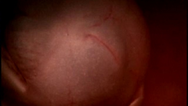 Жизнь до рождения: Кошки смотреть онлайн