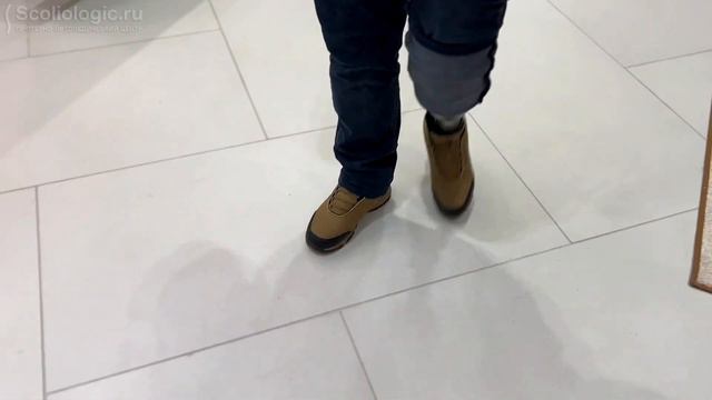 После ампутации ноги с окружением проблем никаких! смотреть онлайн